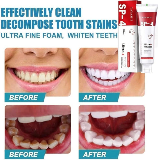 SP-4 Ultra Whitening Toothpaste Probiotic Stain Remover for Bright & Healthy Teeth